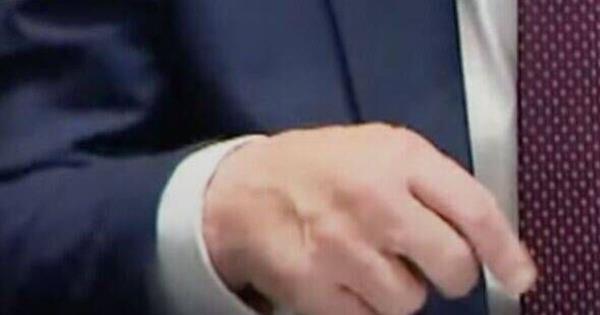 唐纳德·特朗普手部淤青照片引发健康担忧后仅一天便消失